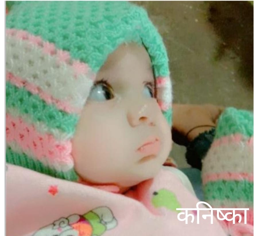 Treatment of child's lip surgery in village Kotisanda Avaldaman
