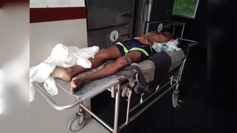 Road accident in Anuppur