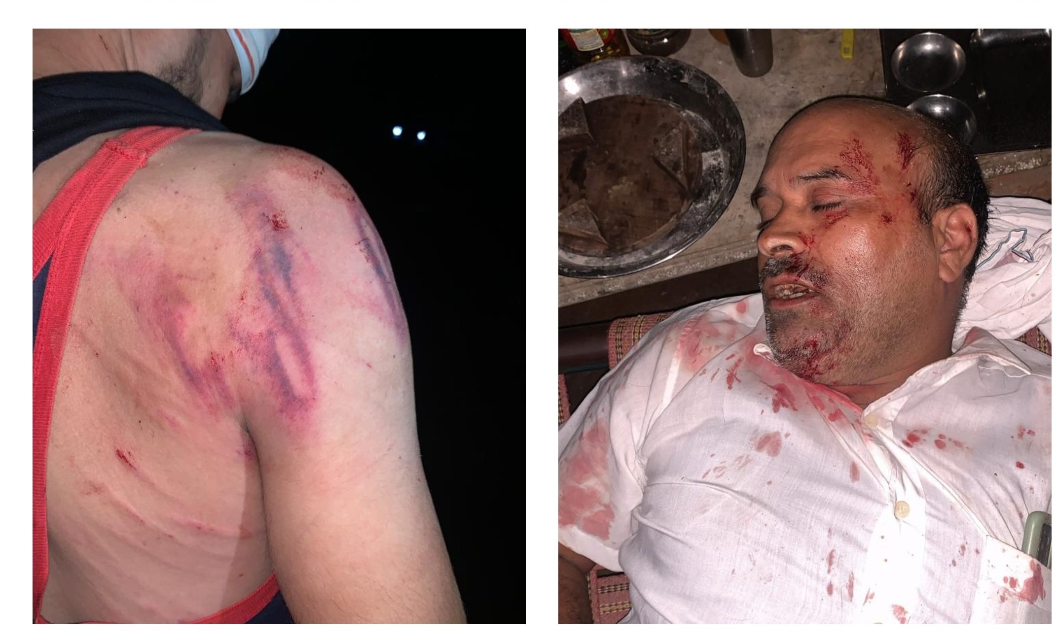 Sand mafia beat up contract company employees, 5 seriously injured, 6 injured